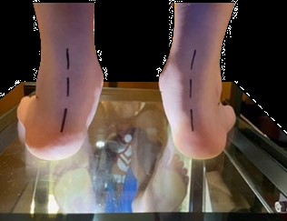 Parallelforskyvning